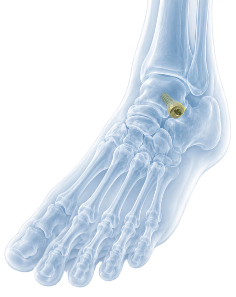 Surgeon education — EOTTS clinical information